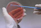 Des sondes ADN pour détecter les bactéries responsables de la dysenterie
